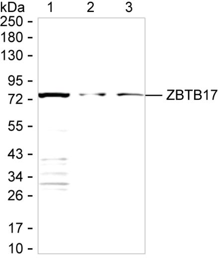 ZBTB17
